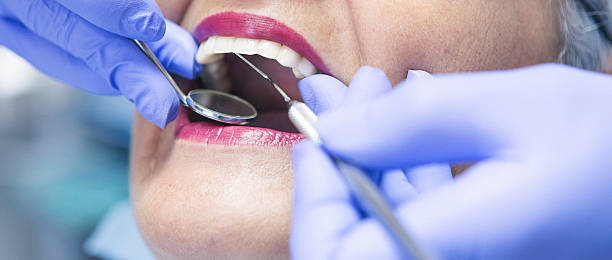 Best Emergency Cosmetic Dentistry in Buffalo, MO